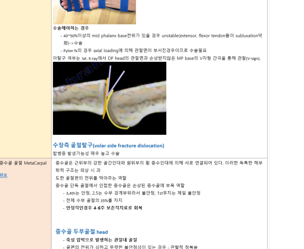 닥터노트 통증 세트오더